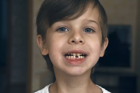 The first milk tooth fell out. closeup