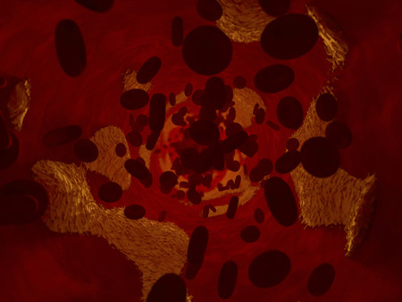 blood cells and cholesterol inside blood vessel.の写真素材
