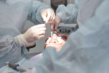 dentist, doctors perform dental surgery, dental implants in the operating roomの写真素材