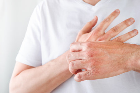 Man scratches or shows hands with dry, cracked skin on white backgrounds. Problem with many people -...