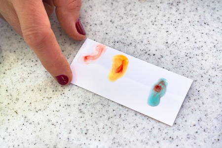 Medical doctor performing a quick blood group determination by using blood type testing kit with anti A and B antibodies on a white card.の写真素材