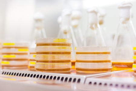 Close up of cell culture samples on LB agar medium in petri dish in laminar flow. Agar plates are...