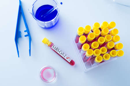 Blood test. Positive result. SARS-CoV-2の写真素材