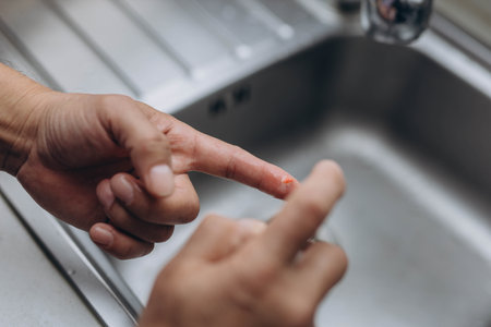 Man cut finger while cooking in kitchen, closeupの写真素材