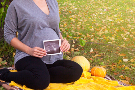 Close up view of ultrasound scan and pregnant tummyの写真素材