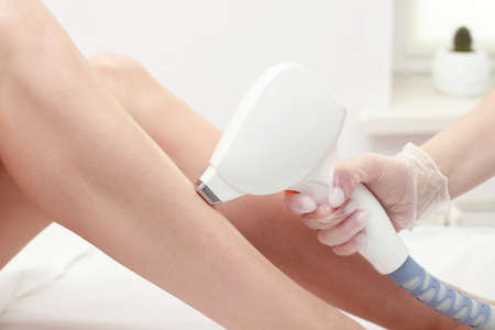 Diode laser hair removal, Beautician removes hair on female legs, laser procedure, Body care epilation treatmentの写真素材