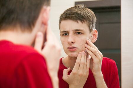 Close up of young attractive man with problematic skin and scars from acne looks in the mirror in the bathroom.の写真素材