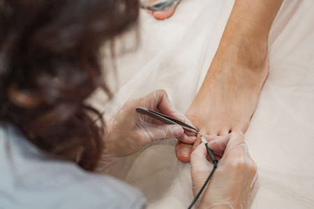 A female cosmetologist performs the procedure of permanent removal of unwanted hair on the toes by electroepilation.の写真素材