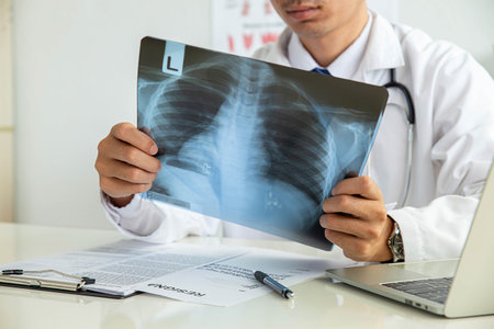 X-ray examination. Skeleton radiology. Woman doctor surgeon holding film scan radiography diagnostic in hospital bone disease treatment.の写真素材