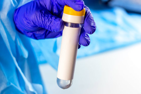 Medical sample in lab tube in the scientist hands in blue medical gloves on light background.