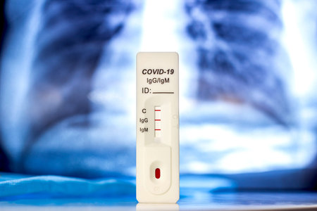 Medical covid-19 antibody and antigen positive rapid self test on blue chest and lungs mri scan...