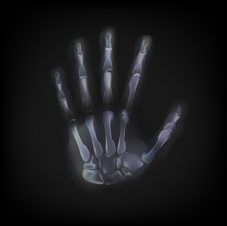 vector x-ray hand on black backgroundのイラスト素材