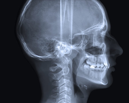 X-ray human  of skull basic