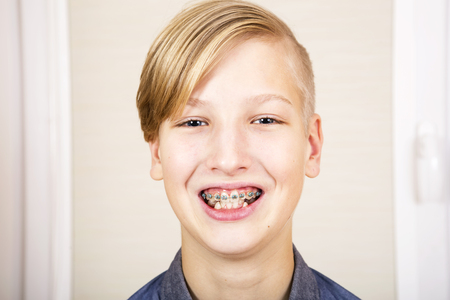 Teen with braces on his teeth. Orthodontics and bite correction.の写真素材
