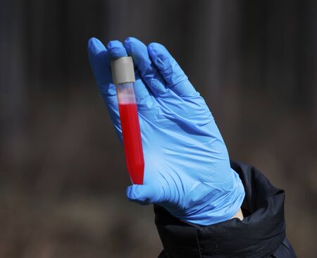 Woman holding test tube with bloodの素材 [FY310143832405]