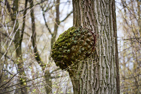 A giant tree burl caused by parasitoid bacteria. A birch tree with cancer