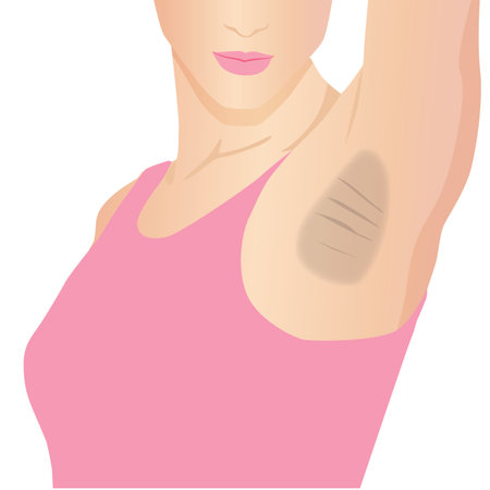 Woman's black armpits have skin problem, illustration cartoon on white backgrounの写真素材