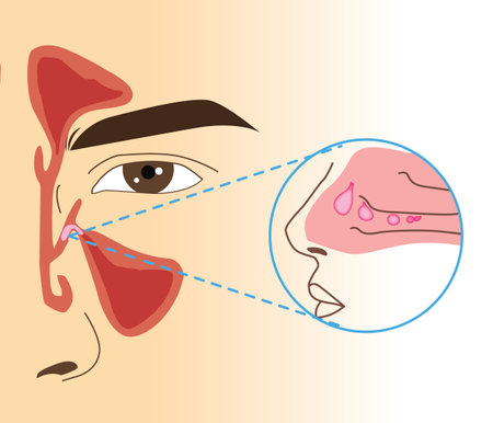 à¹Nasal polyp section in human, illustration close up and zoomの写真素材
