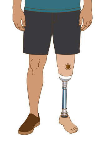 Man with metal prosthetic leg standing, illustration on white backgroundの写真素材