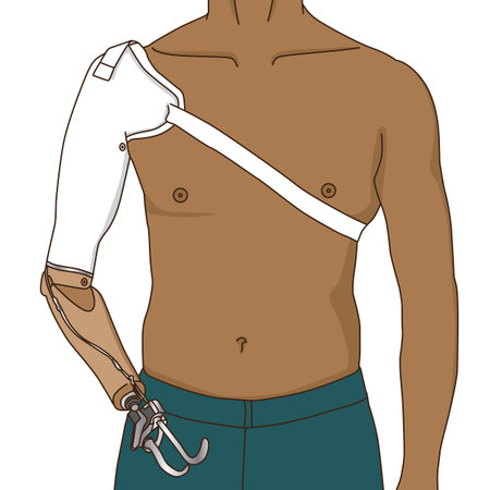 Tan man with metal prosthetic arm standing, illustration on white backgroundの写真素材