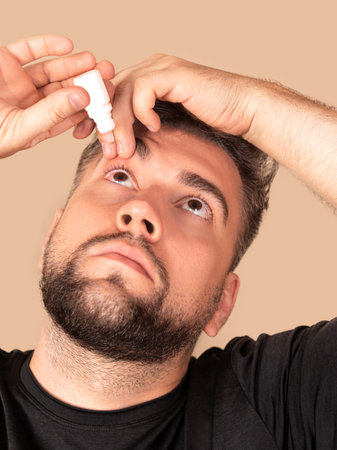 man pours drops in red eye, has conjuctivitis or glaucoma, bad eyesight and pain. Eyes pain treatment concept. Man cures red blood eyeの写真素材