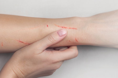Scratches on the woman's hand. Scratches from cat, dog, falls close upの写真素材
