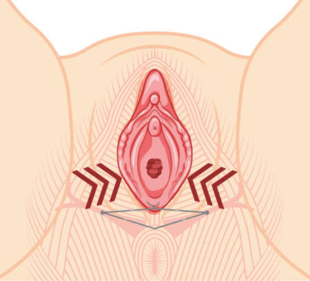 Vaginal lifting with threads Female reproductive system of external genital organs. Front view. Human Surface anatomy of the perineum vulva external organs location scheme, vagina flat style iconのイラスト素材