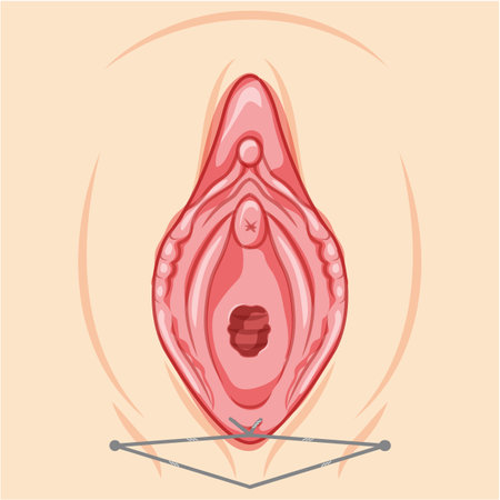Vaginal lifting with threads Female reproductive system of external genital organs. Front view. Human Surface anatomy of the perineum vulva external organs location scheme, vagina flat style iconのイラスト素材