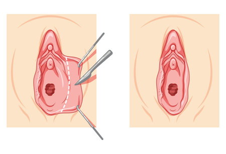 Labiaplasty Female reproductive system process and ready uterus. Vaginoplasty Front view. Human Surface anatomy of the perineum external organs location scheme, vagina pain vulva flat style iconのイラスト素材