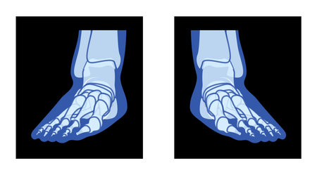 X-Ray Foot Legs Skeleton Human body Bones - malleolus, Phalanges adult people roentgen front view. Realistic flat blue color concept Vector illustration of medical anatomy isolated on black backgroundのイラスト素材