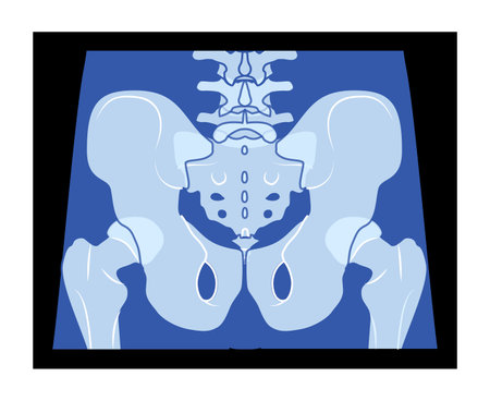 X-Ray pelvis Skeleton Hip Human body Bones adult people roentgen back view. 3D realistic flat blue color concept Vector illustration of medical anatomy isolated on black backgroundのイラスト素材