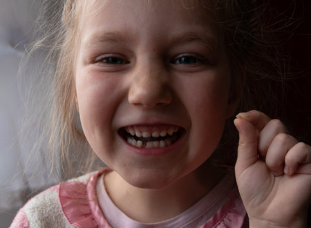 Cute preschooler child wobbling her lower milk tooth and smiling. Deciduous tooth replacement by...