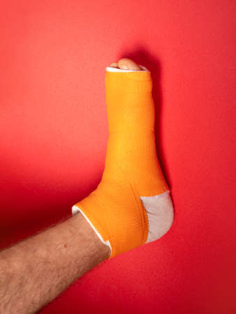 Foot with broken toe bone in orange fiberglass cast pink background. Injured fractured swollen male leg in modern orthopedic waterproof cast made of synthetic thermoplastic glass cloth. Patient body.の写真素材