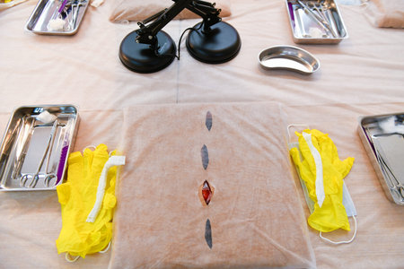 training class in surgery. tumor removal. Training class for tissue extension. children and surgeon....