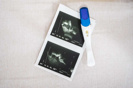 pregnancy test and x-ray of the child. High quality photoの写真素材