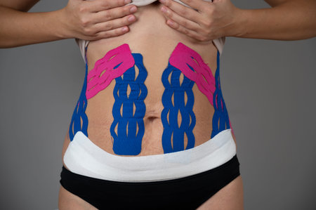 Unknown woman shows her belly with physio tape. The theme kinesiology taping, stretching, recovery conceptの写真素材