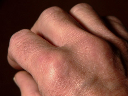 Hands and fingers