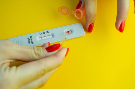 test on a yellow, bright background. medical analysis. test strip to assess the presence of IgG and IgM antibodies. girl with red manicure adds to the strip.の写真素材