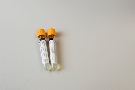 Close-up of test tubes arranged on a tray in medical laboratory. Medical healthcare analysis in a...
