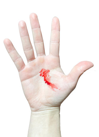A bloody hand on a white background. Bloodstains on the palm of a real bloody handの写真素材