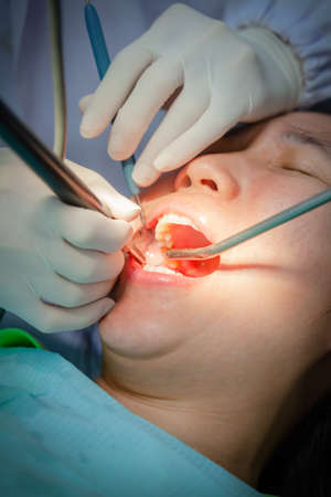 Attractive woman is undergoing dental treatment and specialist wearing rubber gloves is doing check up and curing teeth patient. Oral health concept.の写真素材
