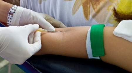 Arterial injection at the crook of the arm women to donate blood の写真素材