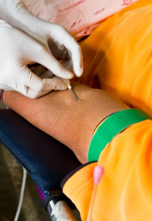 Arterial injection at the crook of the arm women to donate blood の写真素材