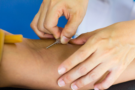 Bare hands do not wear gloves nurse injects a syringe into the arm for blood donors.