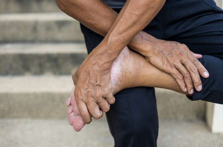 Close-up of both hands of a man holding onto his ankle, suffering from nerve endings beriberi in...