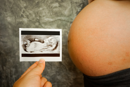 Pregnant Woman Holding Ultrasound Scan Photo