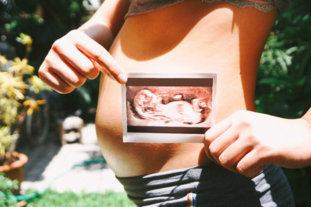Pregnant Woman Holding Ultrasound Scan Photoの写真素材
