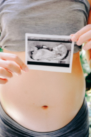 Pregnant Woman Holding Ultrasound Scan Photo blur backgroundの写真素材