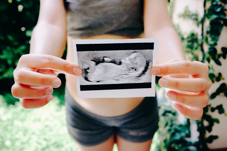 Pregnant Woman Holding Ultrasound Scan Photoの写真素材