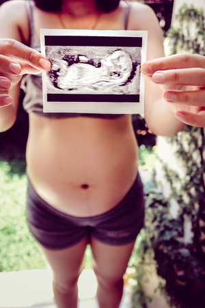 Pregnant Woman Holding Ultrasound Scan Photo